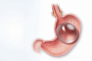 Stomach Paralysis Symptoms: 12 Alarming Causes