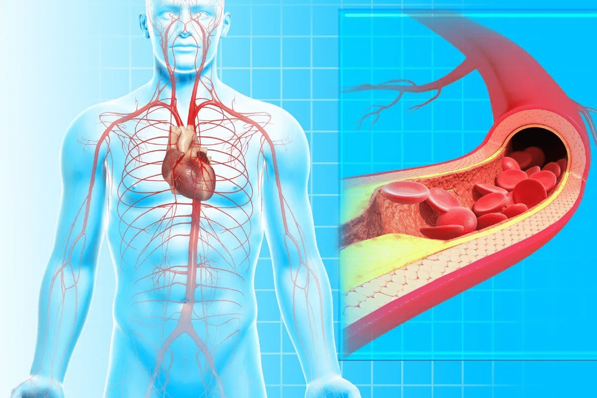 Crucial Life Expectancy After Endarterectomy
