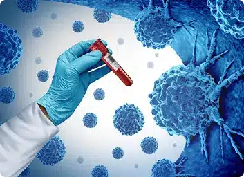 what is cancer staging LIV Hospital