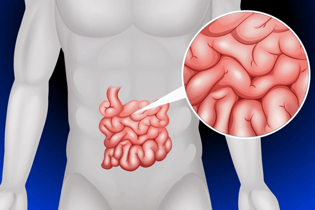 What Is a Lactose Breath Test and How Does It Work?