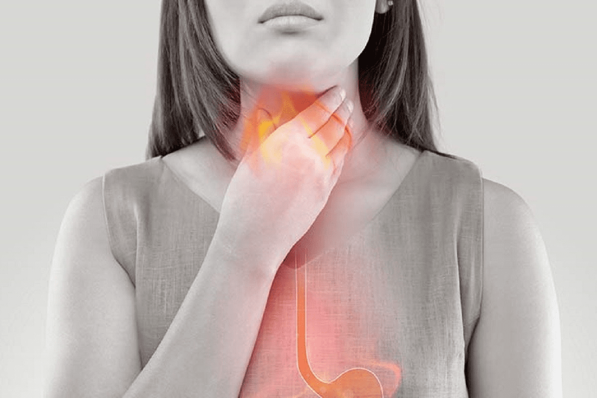 What Does Acid Reflux Feel Like? 7 Alarming Signs