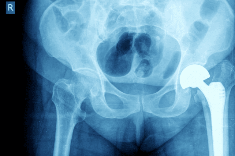 What Does an Abdominal CT Scan Show?