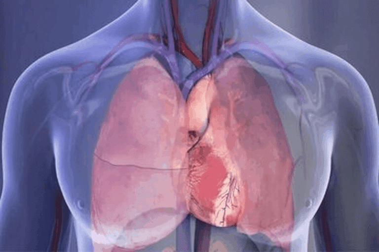 Crucial Stomach Ache When Lying Down