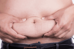 Swelling in Upper Stomach Area: 7 Alarming Causes