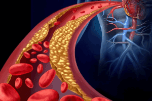 Key Guide: How Often Should Carotid Arteries Be Checked?