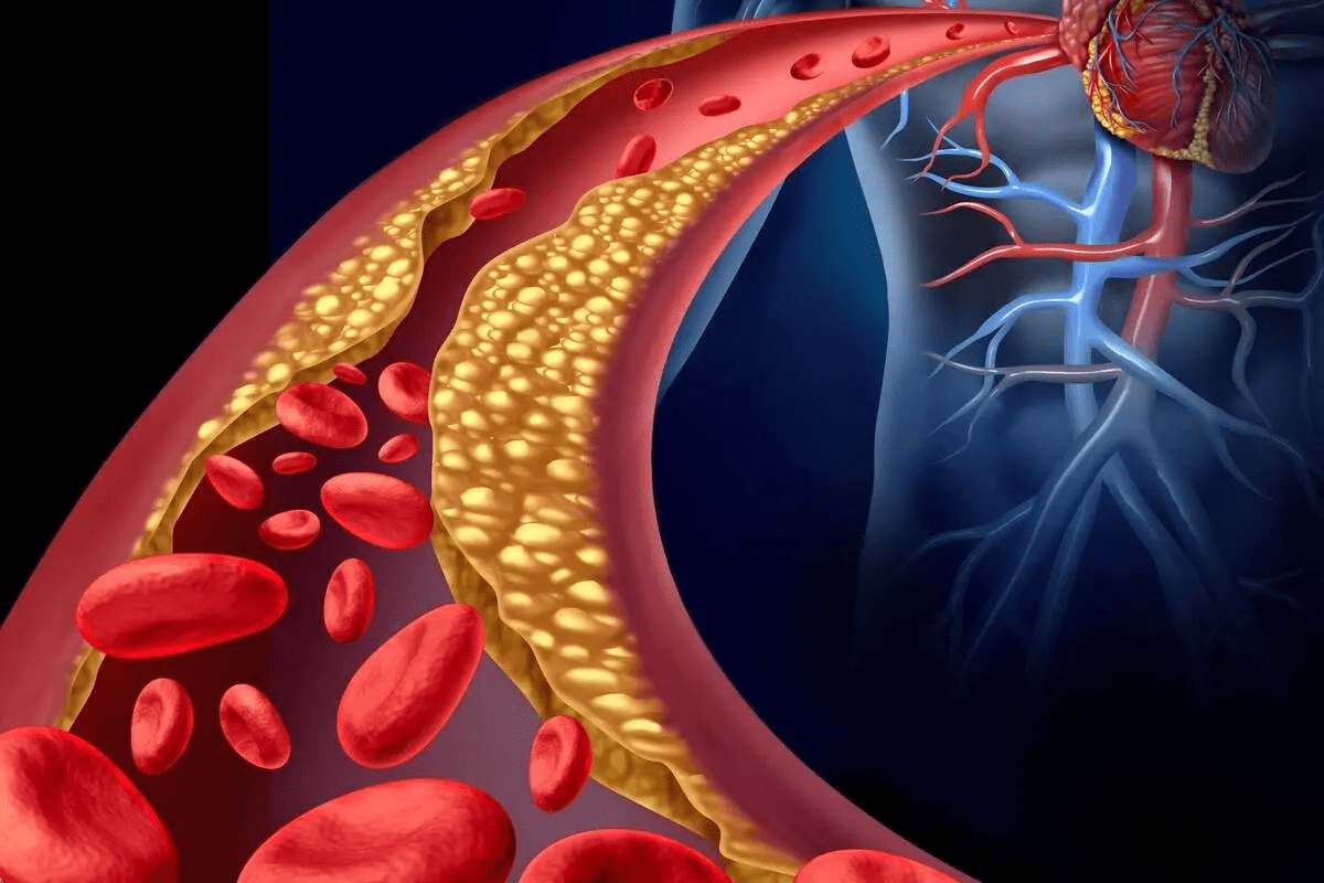 How Often Should Carotid Arteries Be Checked?