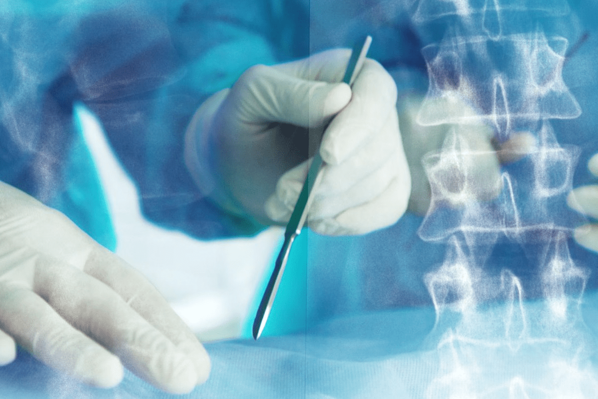 Can spinal decompression be done without surgery?