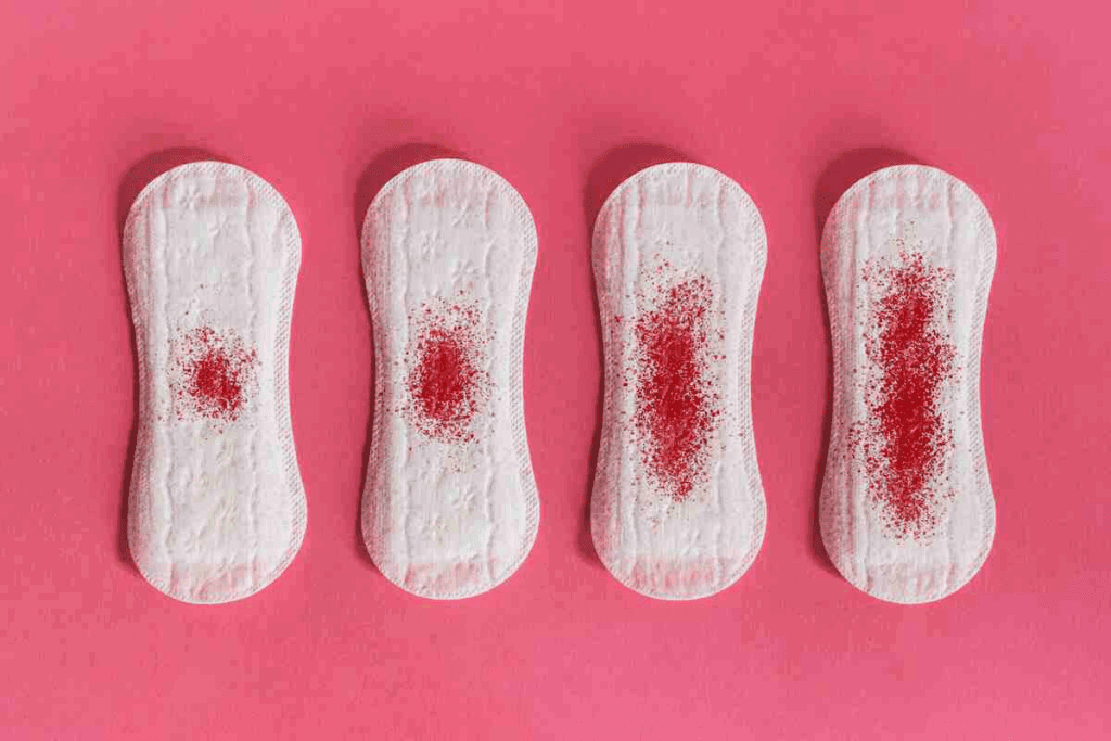 Crucial 2 Months Delayed Menstruation (7 Causes)