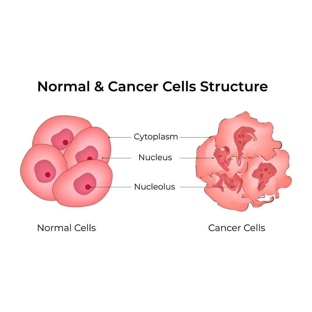 What Does a Cancer Tumor Look Like? Visual Differences Between Cancer Cells and Normal Cells Under a Microscope