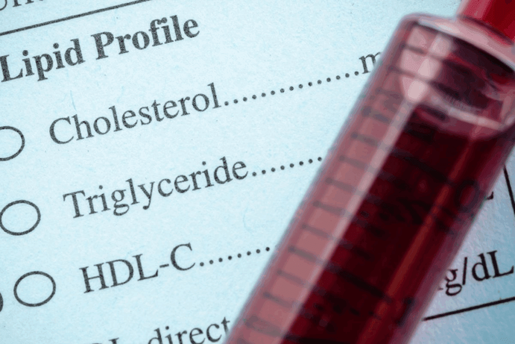Define: Does Alcohol Higher Cholesterol? 3 Define: Does Alcohol Higher Cholesterol?