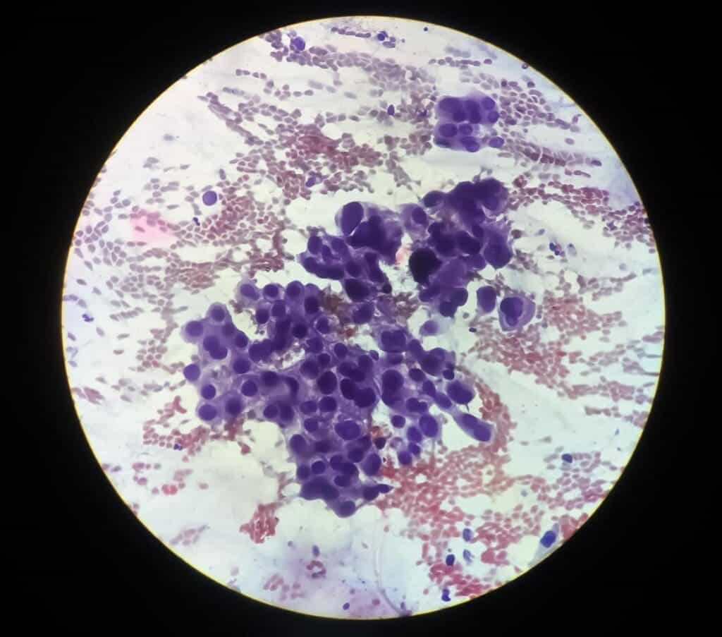 image 26 LIV Hospital