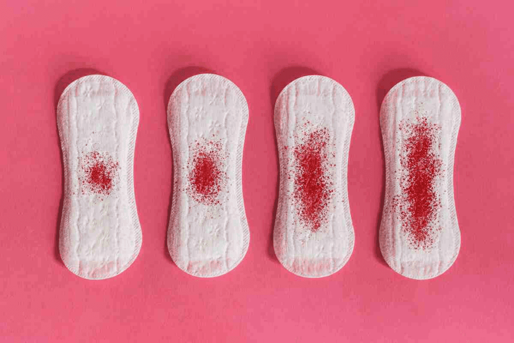 Crucial Delayed Menstruation (10 Causes) 1 Crucial Delayed Menstruation (10 Causes)