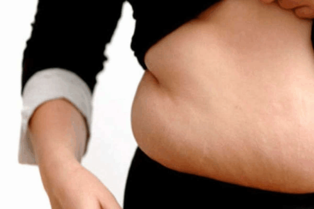 Essential Treatment For Cushing Syndrome