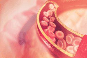 Define: Does Stress Increase Cholesterol?