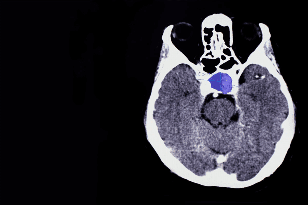 Crucial Pituitary Gland Hypothalamus Hormones