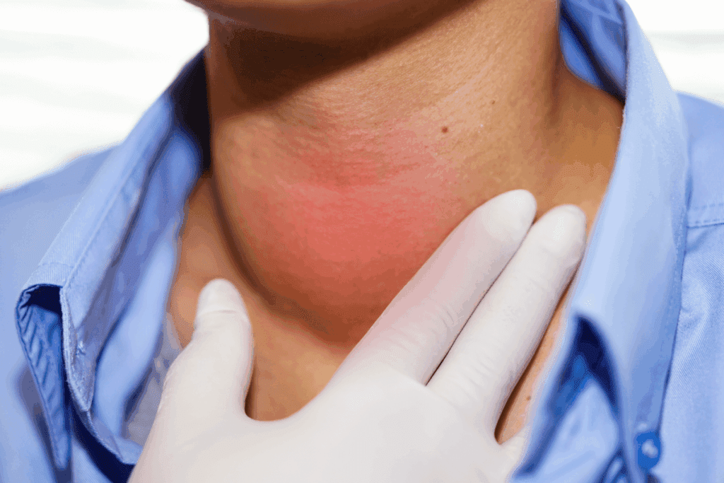 Define: Will Hyperthyroidism Cause Weight Gain?