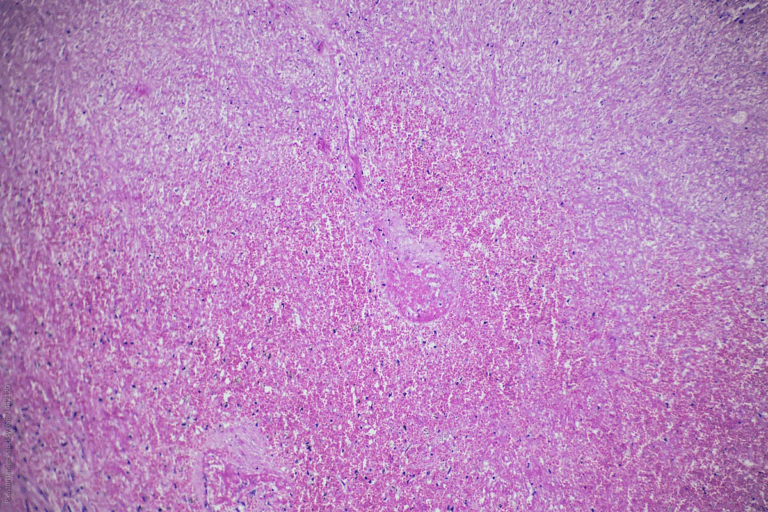 Key Posterior Pituitary Gland Hormones