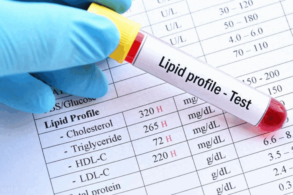 Abnormal Lipid Panel: Understanding Cholesterol Levels & Reference Ranges