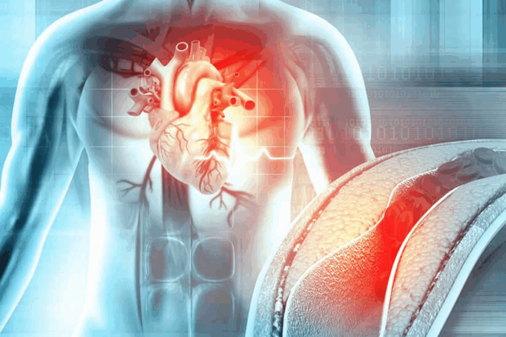 Define: What Is Arteriosclerosis And Atherosclerosis