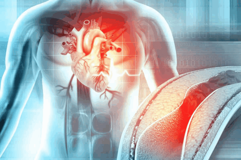 Define: What Is Arteriosclerosis And Atherosclerosis