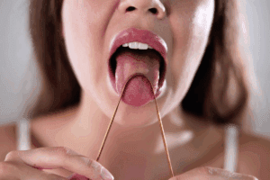 Malignant Melanoma Mouth Symptoms: 5 Alarming Signs