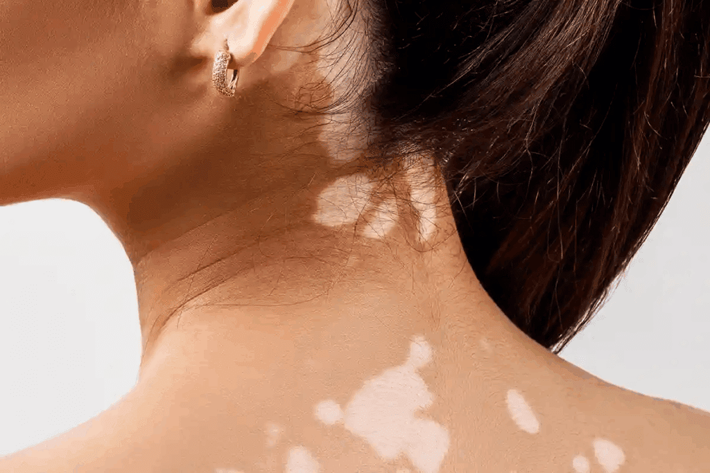 Spots on Back of Tongue and Sore Throat: 5 Alarming