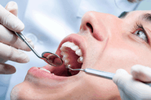 Mini Implant Dentures: Your Ultimate Guide