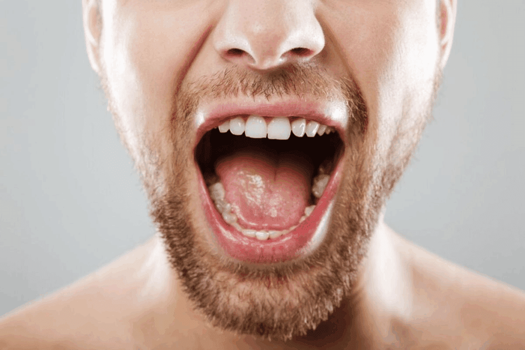 Oral Hairy Leukoplakia: Your Ultimate Guide (EBV)