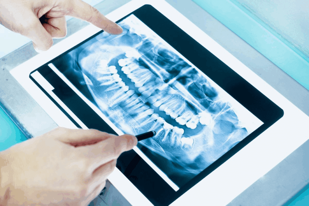 How Much Radiation in a Dental X Ray? Surprising Facts