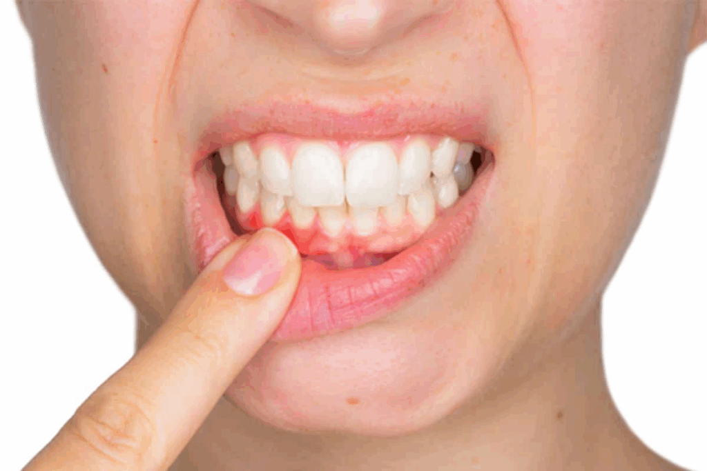 Gum Lesions: 7 Alarming Types & Treatments