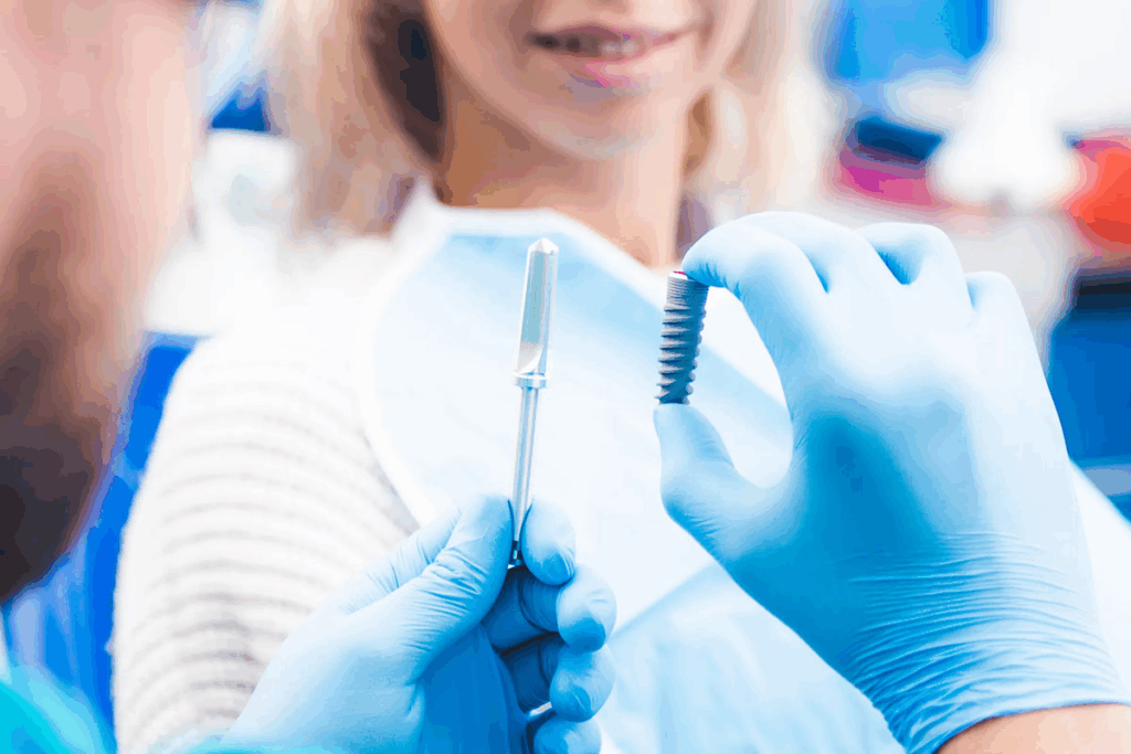 Mini Dental Implants vs Regular Implants: Best Choice