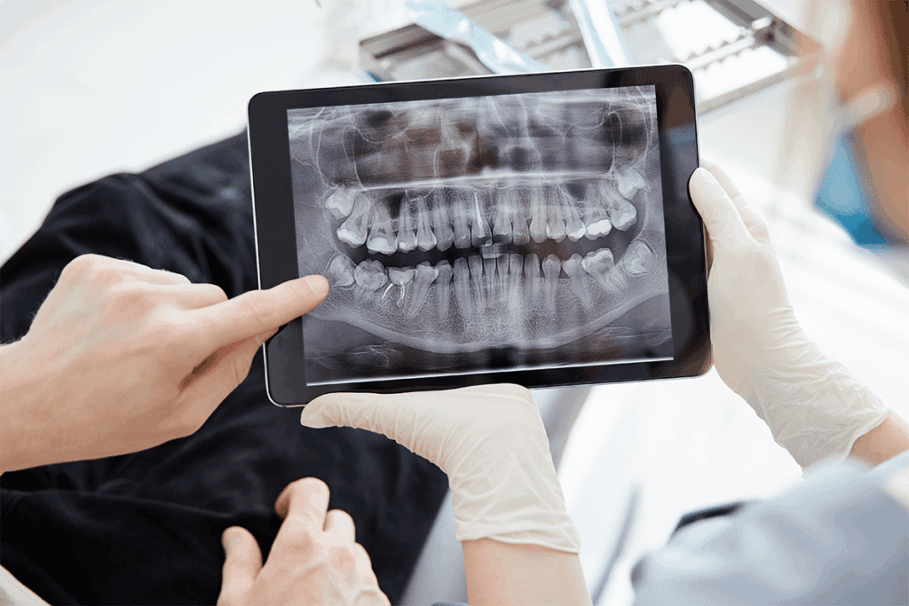 Perfect Oral Xray: Your Ultimate Guide to Frequency