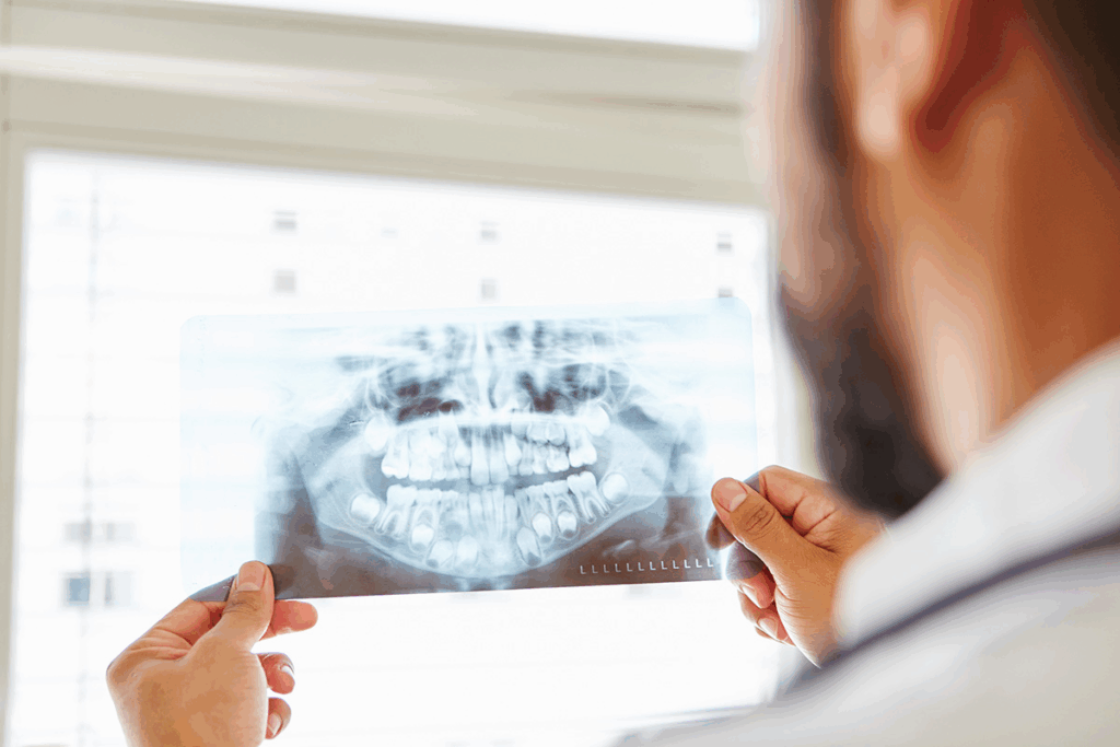 Bitewing X Ray: Your Ultimate Guide (5 Key Facts)