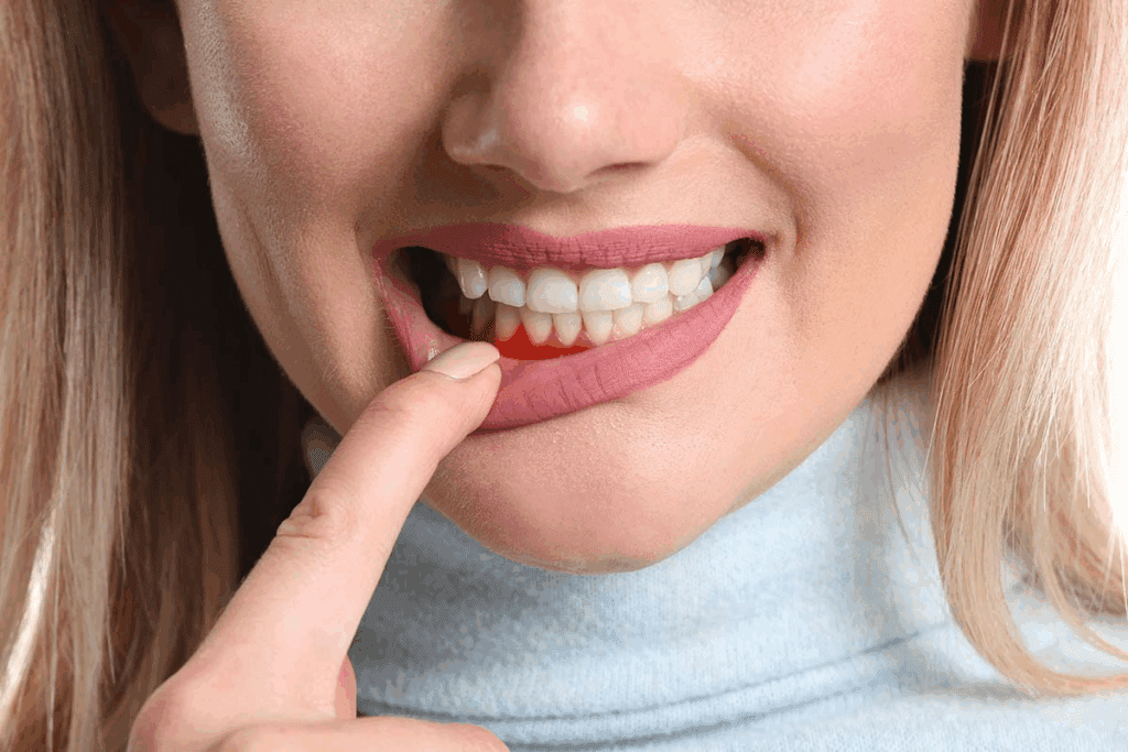 Blood Blister in Mouth Cancer: 5 Alarming Facts