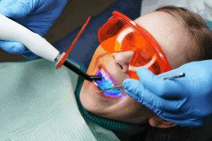Tooth Filling: Your Ultimate Guide to Restorations