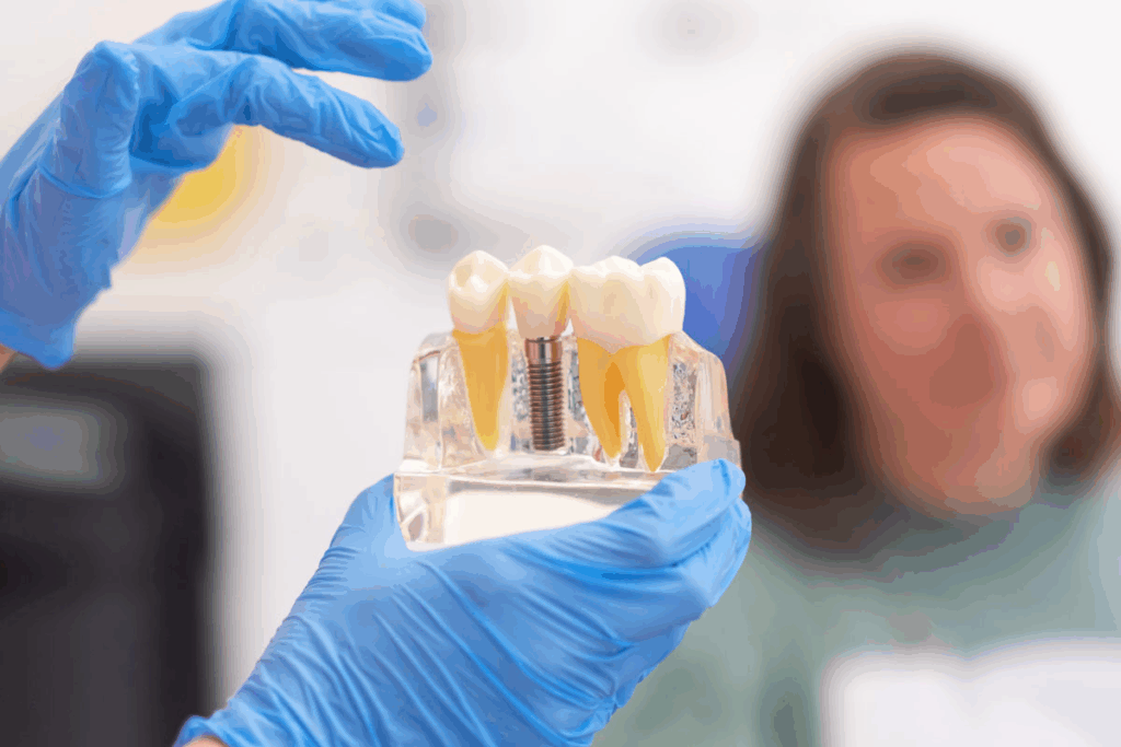 Alternative to Implants for Missing Teeth: 5 Best