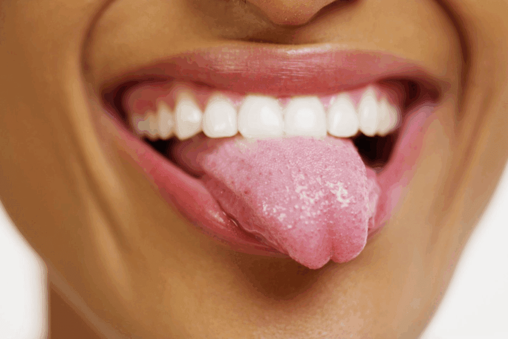 Tongue Cancer Survival Statistics: The Key Facts