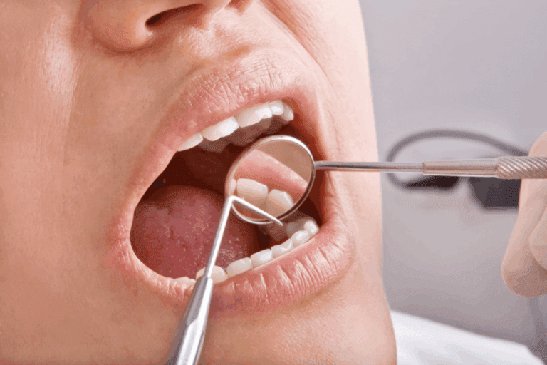 Tooth Filling Procedure: The Ultimate Guide