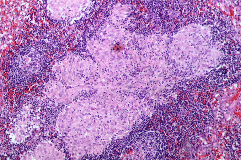 Mouth Cancer Prognosis: Your Ultimate Guide