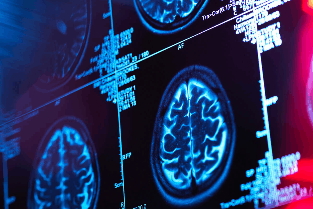 Best state neurosurgery: The ultimate rankings