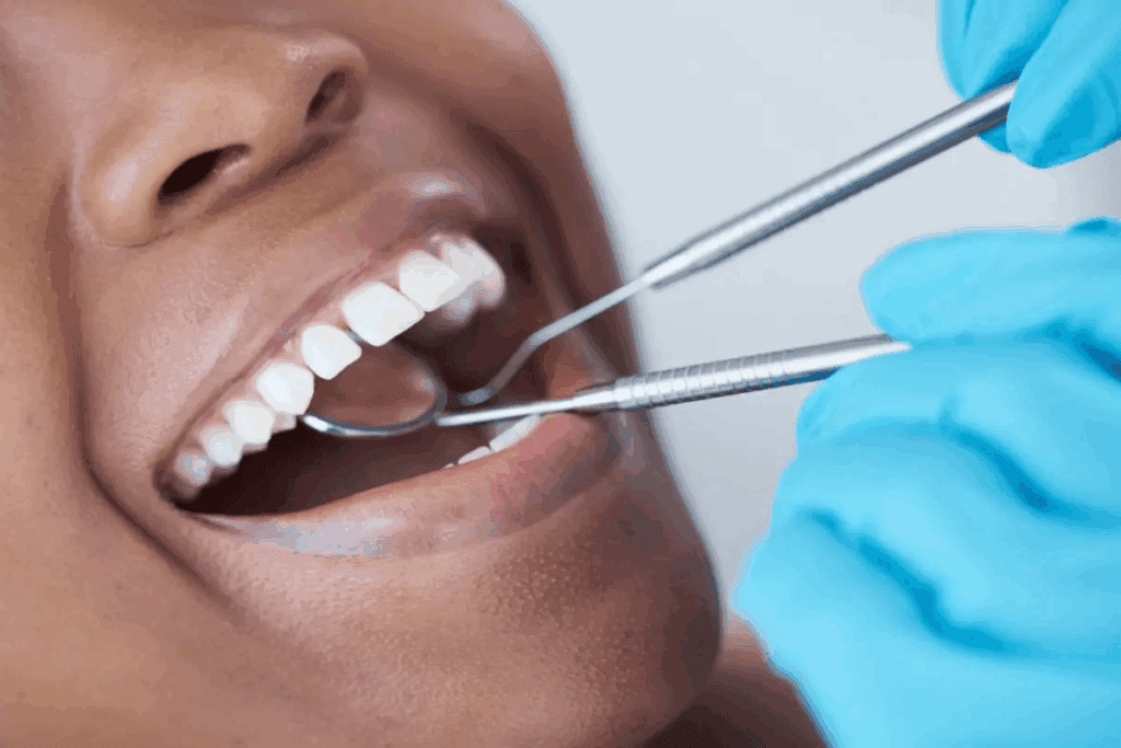 How to Get a Complete Mouth Restoration: Your Step-by-Step Guide