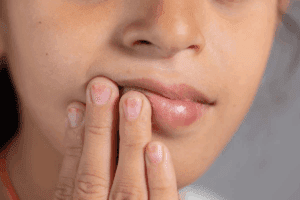7 Signs Of Oral Cancer On Lip: Early Detection Guide