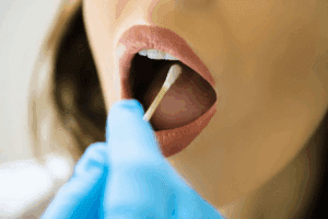 First Stage of Gum Cancer: 5 Alarming Signs