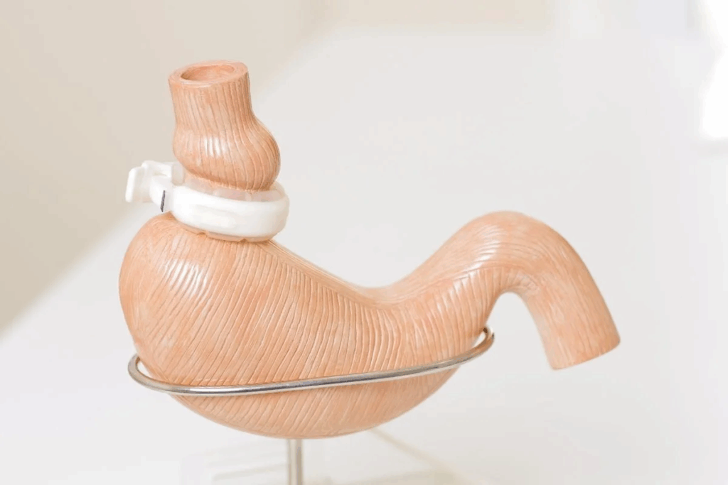 Gastric Sleeve Before And After Skin Changes Explained