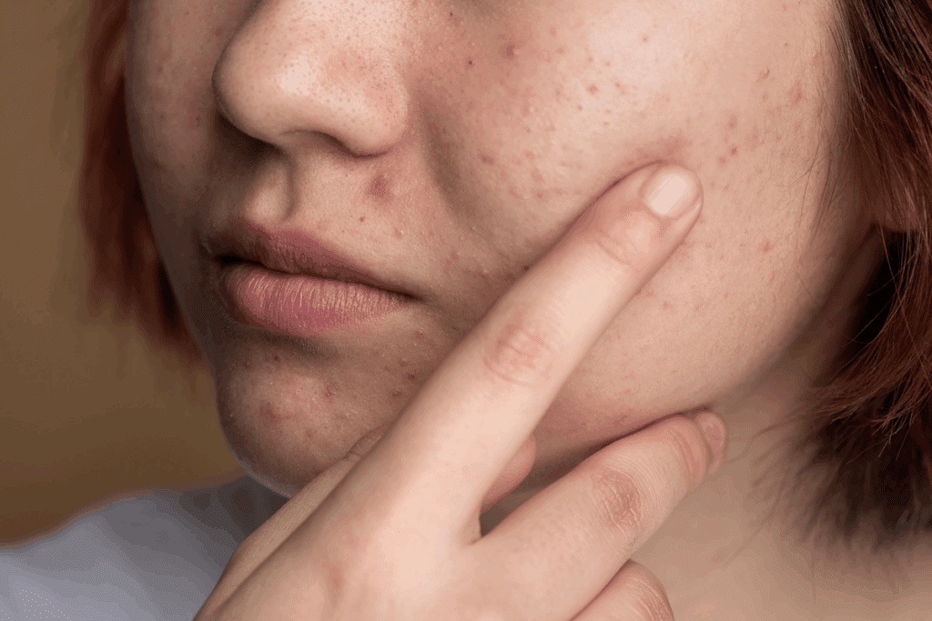 What Causes A Lump In Inside Of Cheek And When Should You Worry?