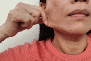 What Causes A Growth On Cheek Inside Mouth And When To Worry?