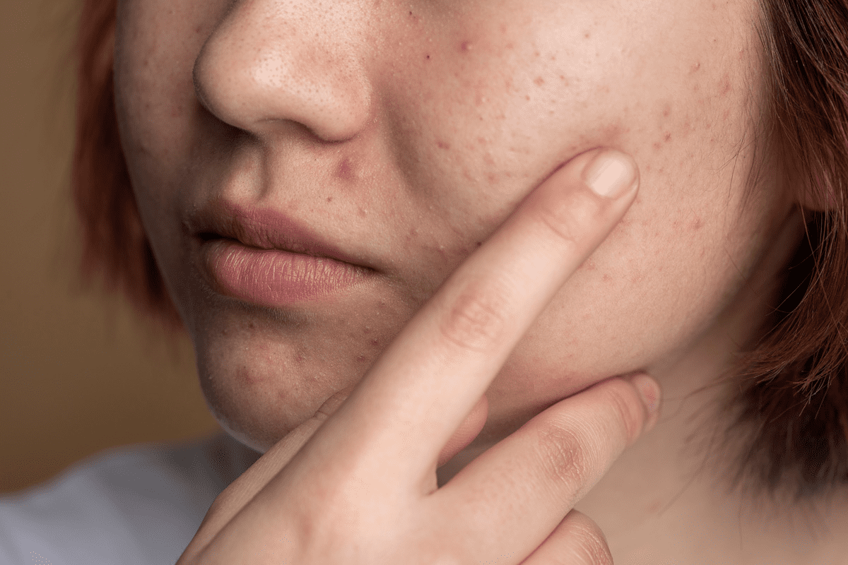 What Causes A Lump Inside Of Cheek In Mouth And When To Worry?
