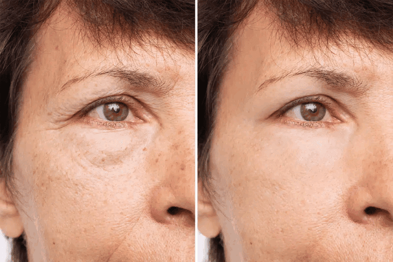 Face Changes After Chemo: The Surprising Truth