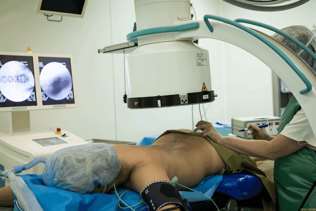 L4 L5 fusion: How critical is this surgery?