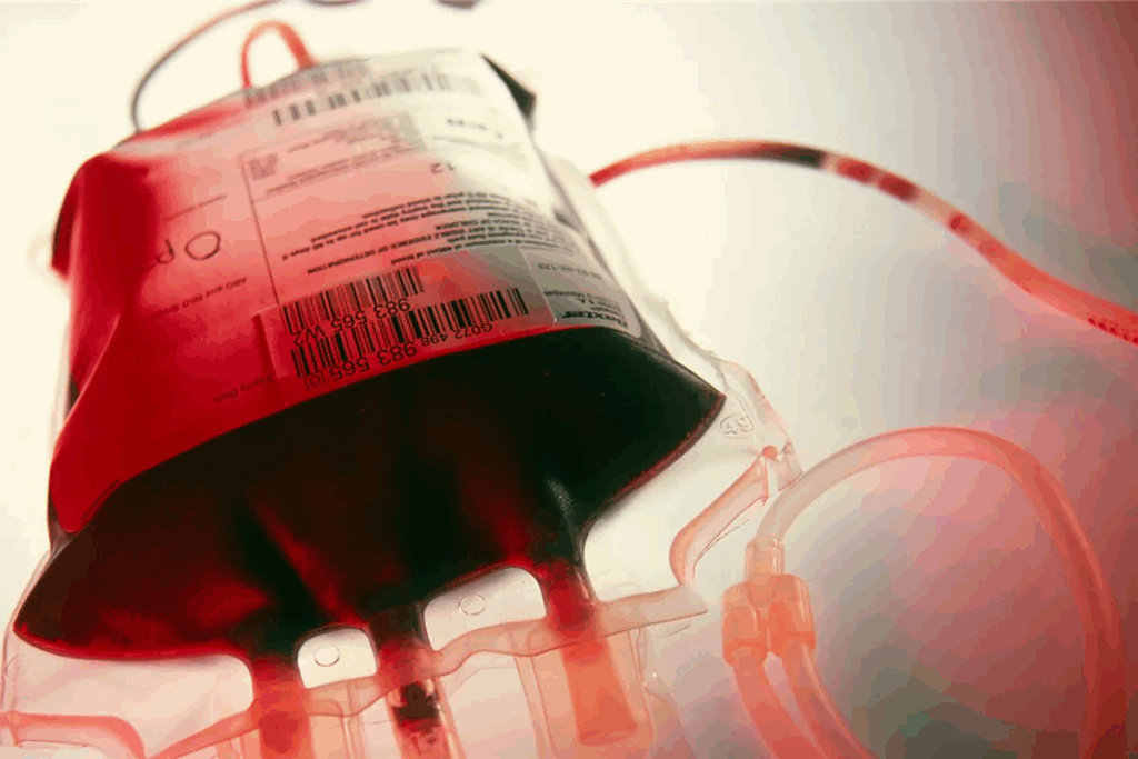 Blood Transfusion: Two Major Risks Explained